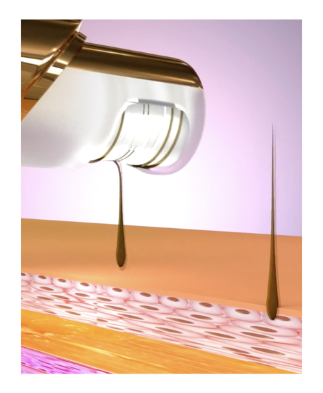 Velform Epilwiz Precision Epilator